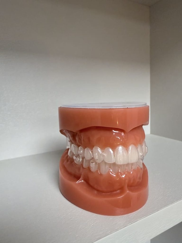 angel-aligner-montreal